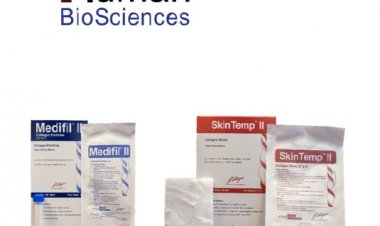 Treatment of Burn Injuries on Diwali: HBS Collagen Products Can be More Effective in Advanced  Wound Care