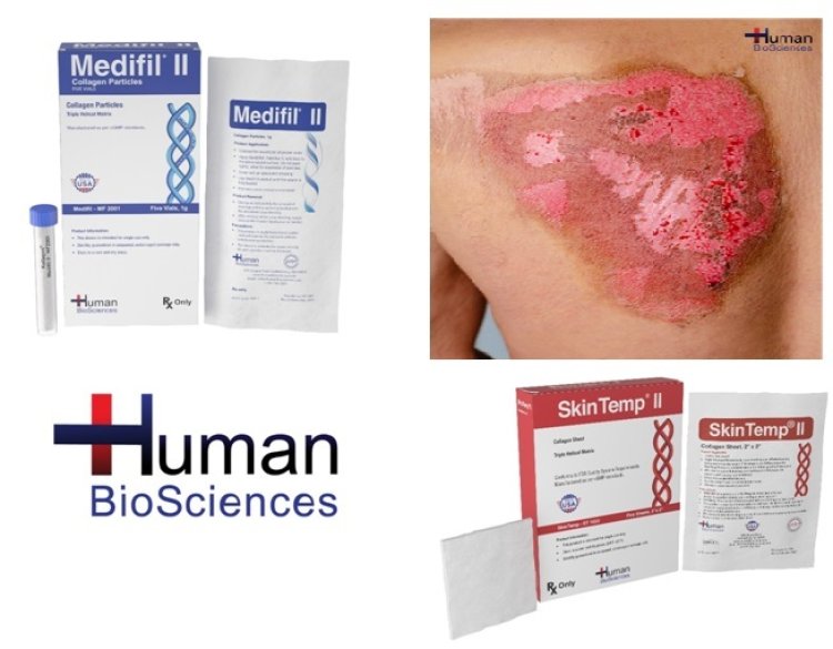 First aid response to burns can improve outcomes